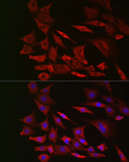 [KO Validated] PTEN Rabbit monoclonal antibody
