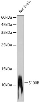 S100B Rabbit monoclonal antibody