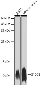 S100B Rabbit monoclonal antibody
