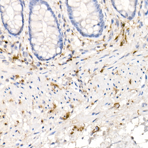 S100B Rabbit monoclonal antibody