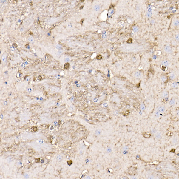 S100B Rabbit monoclonal antibody