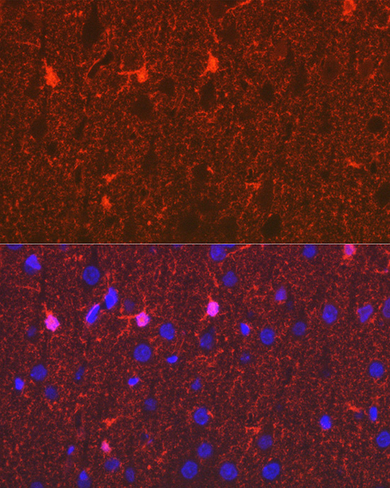 S100B Rabbit monoclonal antibody