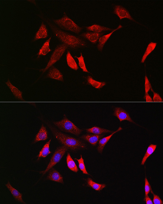 SHP2 Rabbit monoclonal antibody