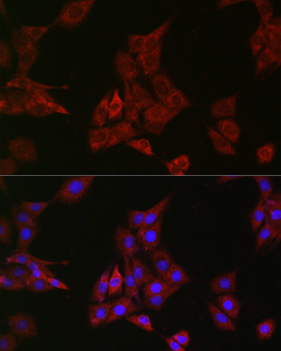 SHP2 Rabbit monoclonal antibody