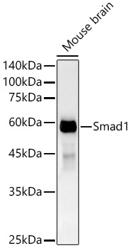 [KO Validated] Smad1 Rabbit monoclonal antibody
