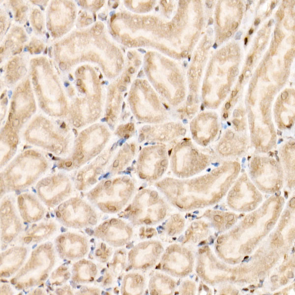 [KO Validated] Smad1 Rabbit monoclonal antibody