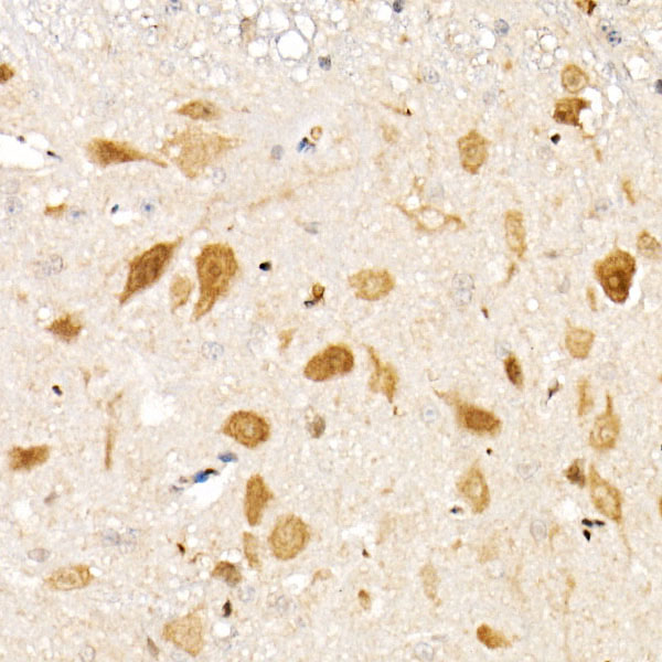 [KO Validated] Smad1 Rabbit monoclonal antibody