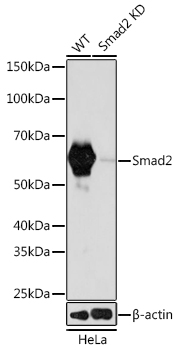 [KD Validated] Smad2 Rabbit monoclonal antibody