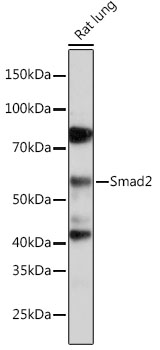 [KD Validated] Smad2 Rabbit monoclonal antibody
