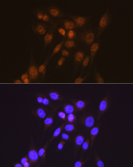 [KD Validated] Smad2 Rabbit monoclonal antibody