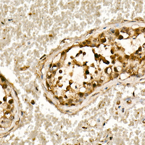 [KO Validated] Smad3 Rabbit monoclonal antibody