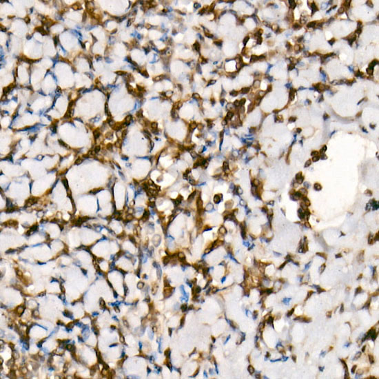 [KO Validated] Smad3 Rabbit monoclonal antibody