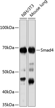 [KO Validated] Smad4 Rabbit monoclonal antibody