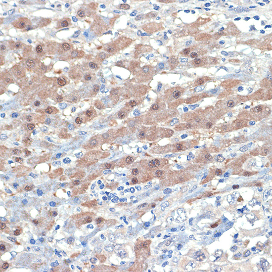[KO Validated] Smad4 Rabbit monoclonal antibody