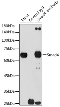 [KO Validated] Smad4 Rabbit monoclonal antibody