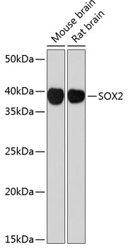 SOX2 Rabbit monoclonal antibody