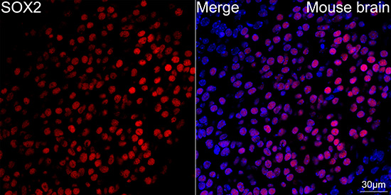SOX2 Rabbit monoclonal antibody