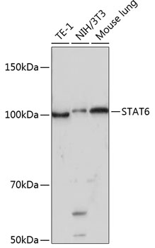 STAT6 Rabbit monoclonal antibody