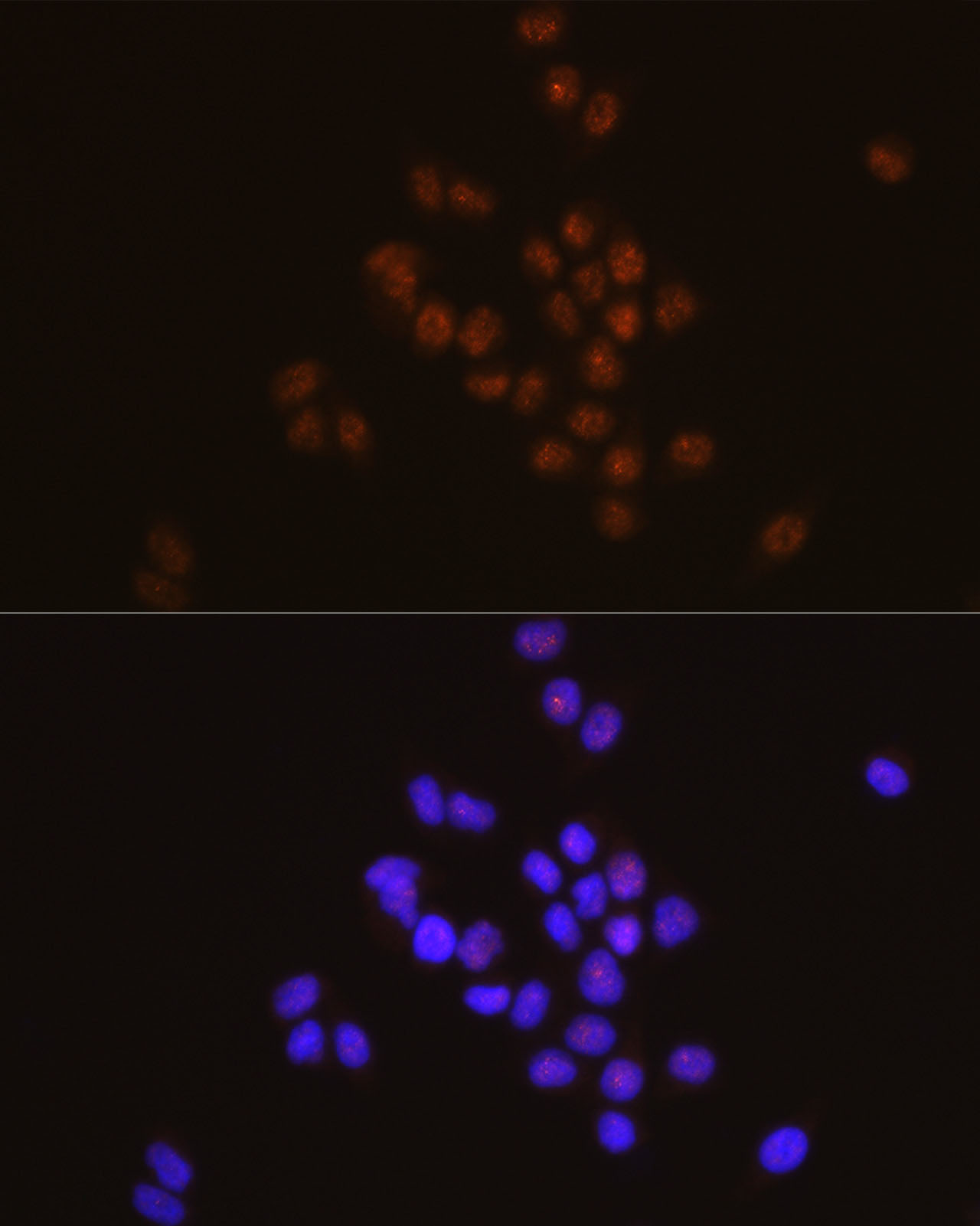 STAT6 Rabbit monoclonal antibody
