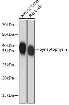 Synaptophysin Rabbit monoclonal antibody