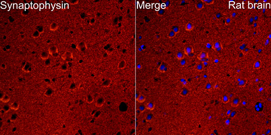 Synaptophysin Rabbit monoclonal antibody
