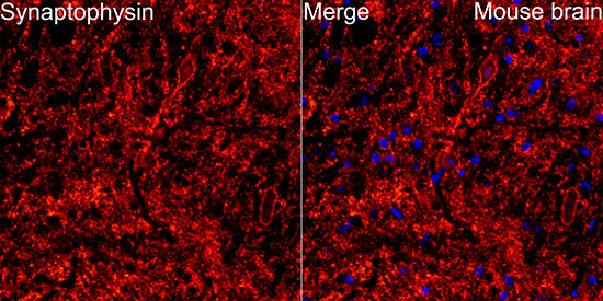 Synaptophysin Rabbit monoclonal antibody