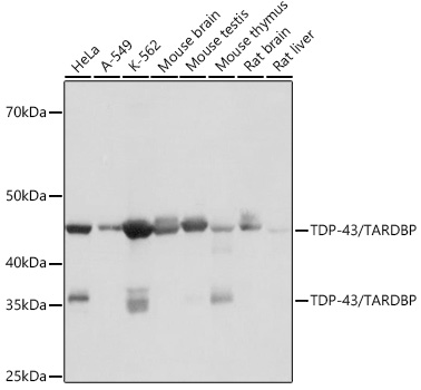TDP-43/TARDBP Rabbit monoclonal antibody