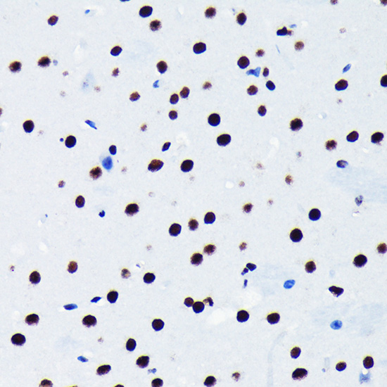 TDP-43/TARDBP Rabbit monoclonal antibody