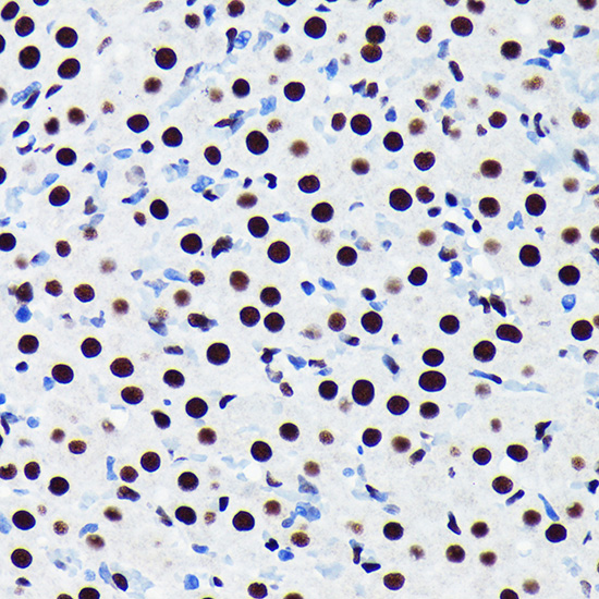 TDP-43/TARDBP Rabbit monoclonal antibody