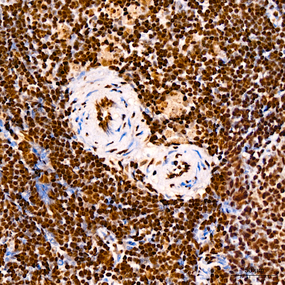 TDP-43/TARDBP Rabbit monoclonal antibody