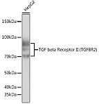 Western blot - TGF beta Receptor II (TGFBR2) Rabbit mAb (A19124)