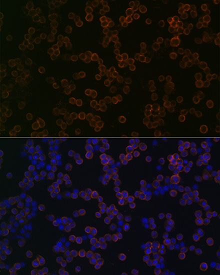 TLR2 Rabbit monoclonal antibody