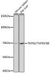 Western blot - TNFR2/TNFRSF1B Rabbit mAb (A19127)