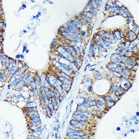 TNFAIP3 Rabbit monoclonal antibody