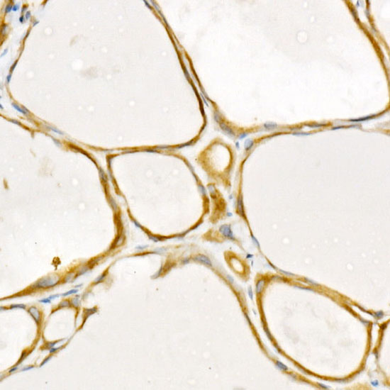 [KD Validated] TRAF2 Rabbit monoclonal antibody