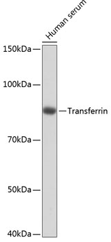 Transferrin Rabbit monoclonal antibody