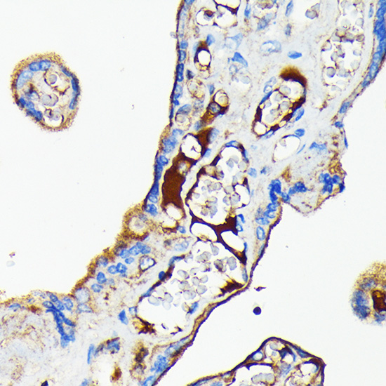 Transferrin Rabbit monoclonal antibody