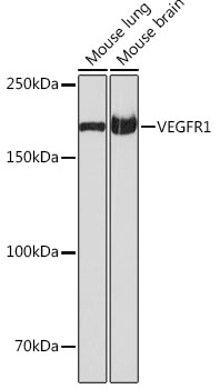 VEGFR1 Rabbit monoclonal antibody