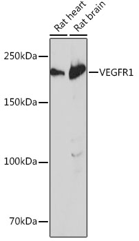VEGFR1 Rabbit monoclonal antibody