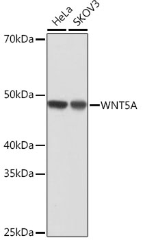 WNT5A Rabbit monoclonal antibody