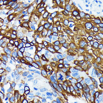 WNT5A Rabbit monoclonal antibody