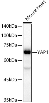 [KO Validated] YAP1 Rabbit monoclonal antibody