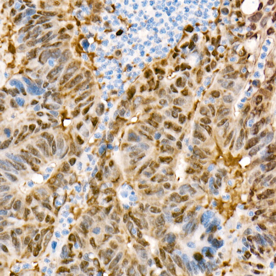[KO Validated] YAP1 Rabbit monoclonal antibody