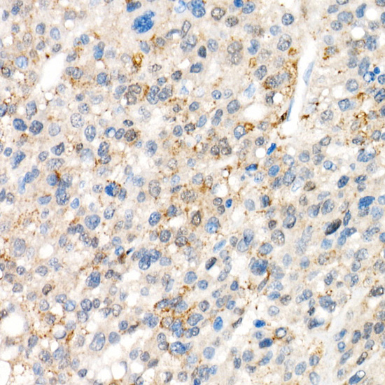 [KO Validated] YAP1 Rabbit monoclonal antibody
