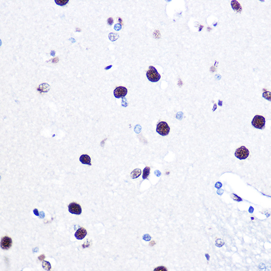 hnRNP C Rabbit polyclonal antibody