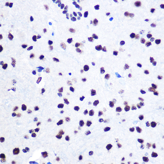 hnRNP C Rabbit polyclonal antibody