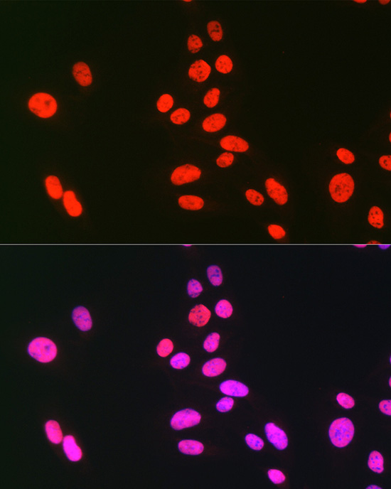 hnRNP C Rabbit polyclonal antibody