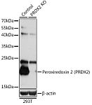 Western blot - [KO Validated] Peroxiredoxin 2 (PRDX2) Rabbit pAb (A1919)