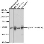 Western blot - Glycerol kinase (GK) Rabbit mAb (A19221)