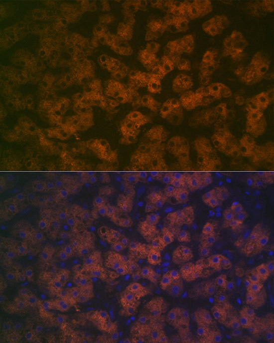FMO3 Rabbit monoclonal antibody